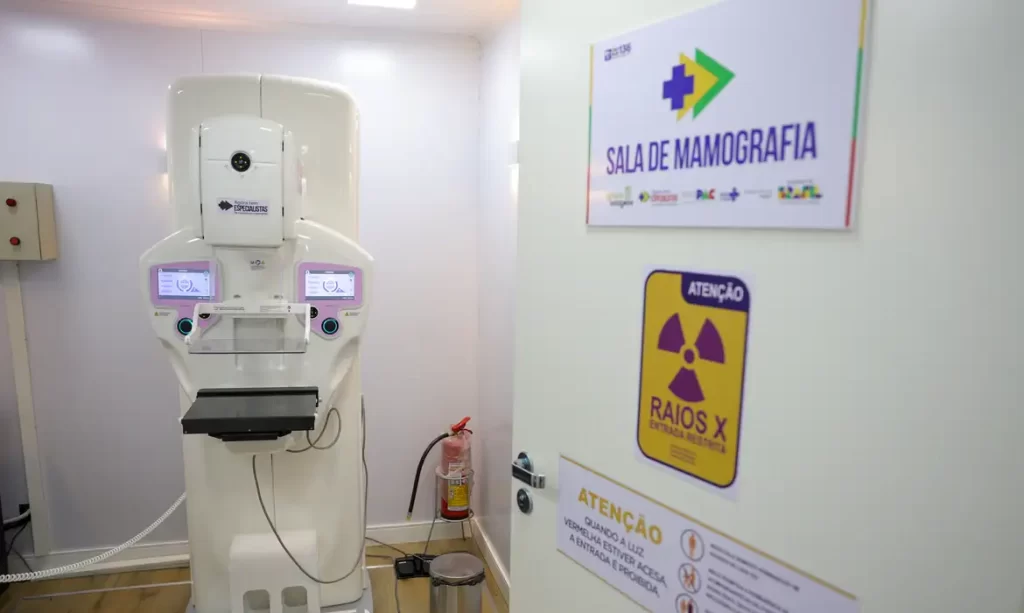 Lei garante mamografia pelo SUS a mulheres a partir de 40 anos
