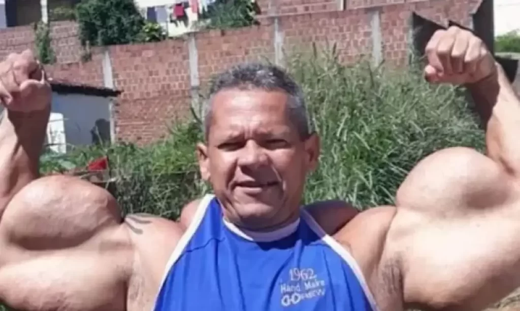 Morre Arlindo de Souza, o “Popeye Brasileiro”, aos 55 anos