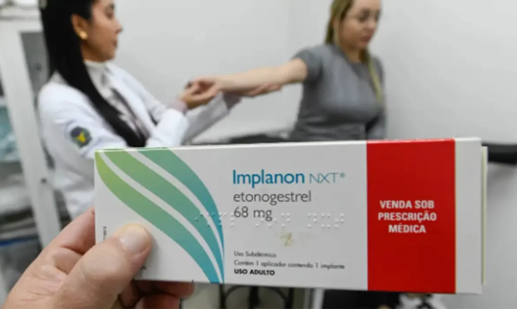 SUS qualifica profissionais para ampliar acesso a implantes hormonais