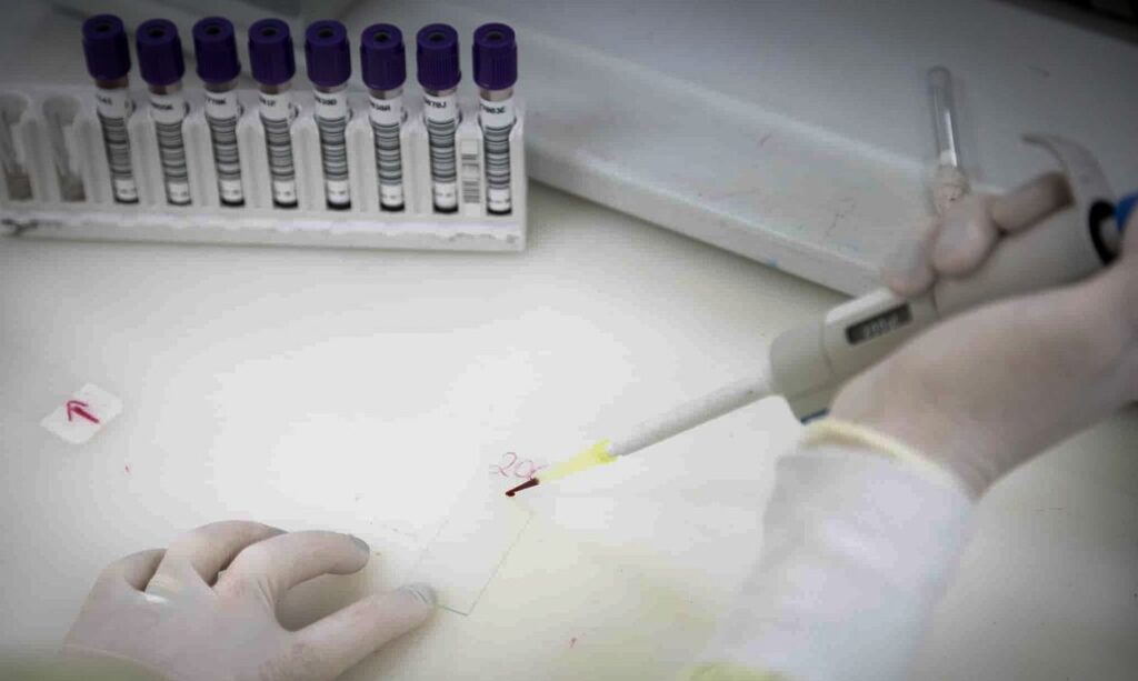 Casos suspeitos de Ebola caem drasticamente após revisão de dados
