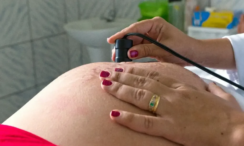 Bolsa família está associado à redução de mortalidade materna e infantil, aponta pesquisa