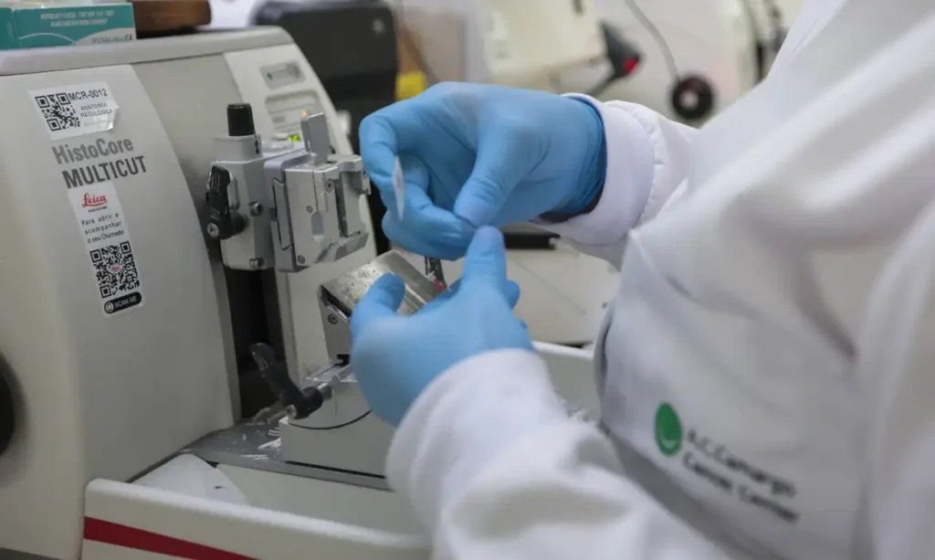 SUS incorpora nova terapia para adultos com leucemia mieloide aguda